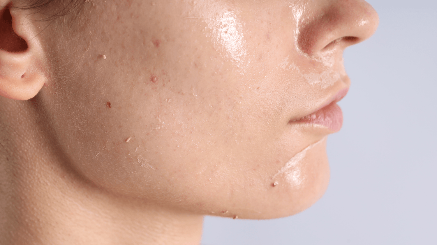 Client journey: improving dull, tired skin with a personalised treatment plan
