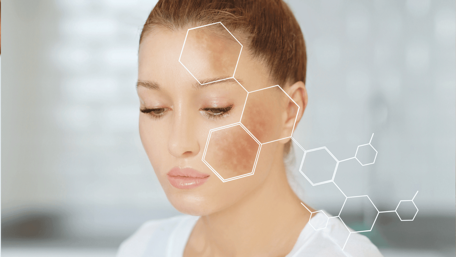 Obagi Medical for hyperpigmentation: where to start