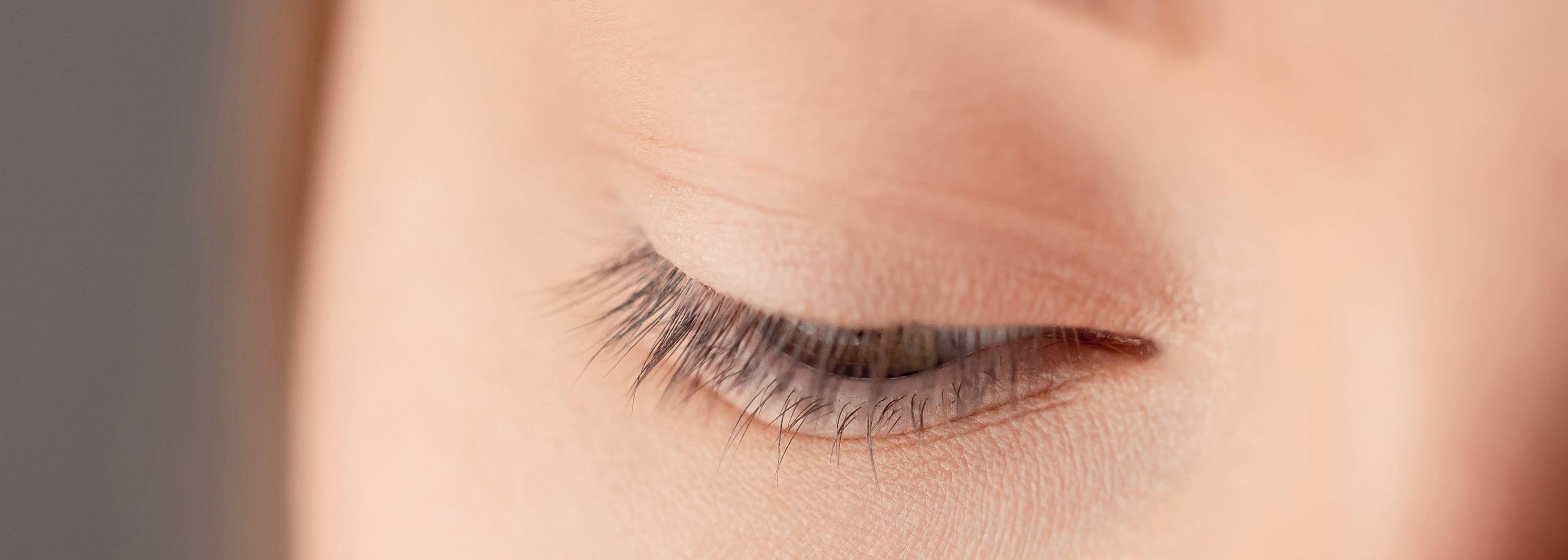 Thinning Lashes & Brows
