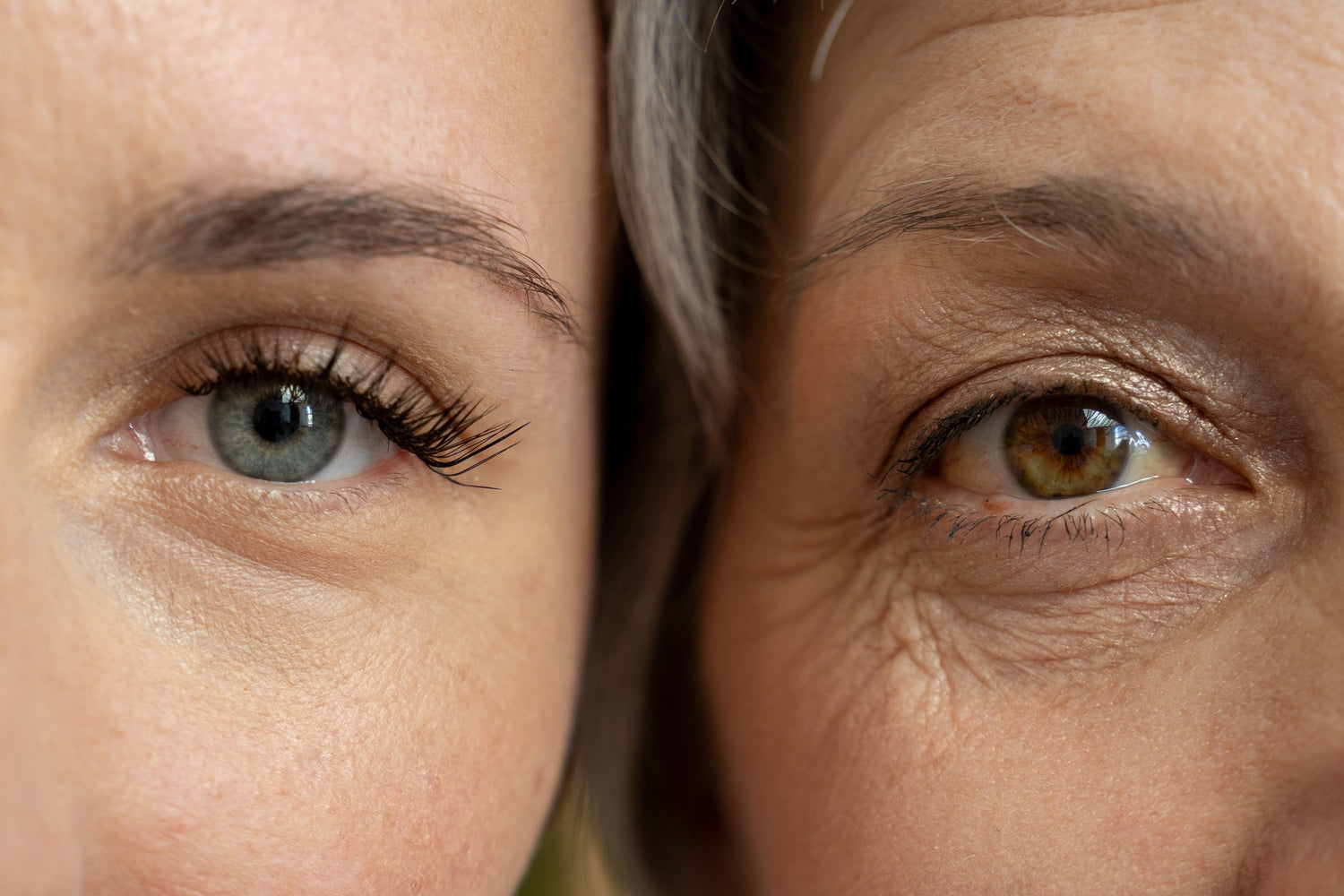 Fine Lines &amp; Wrinkles