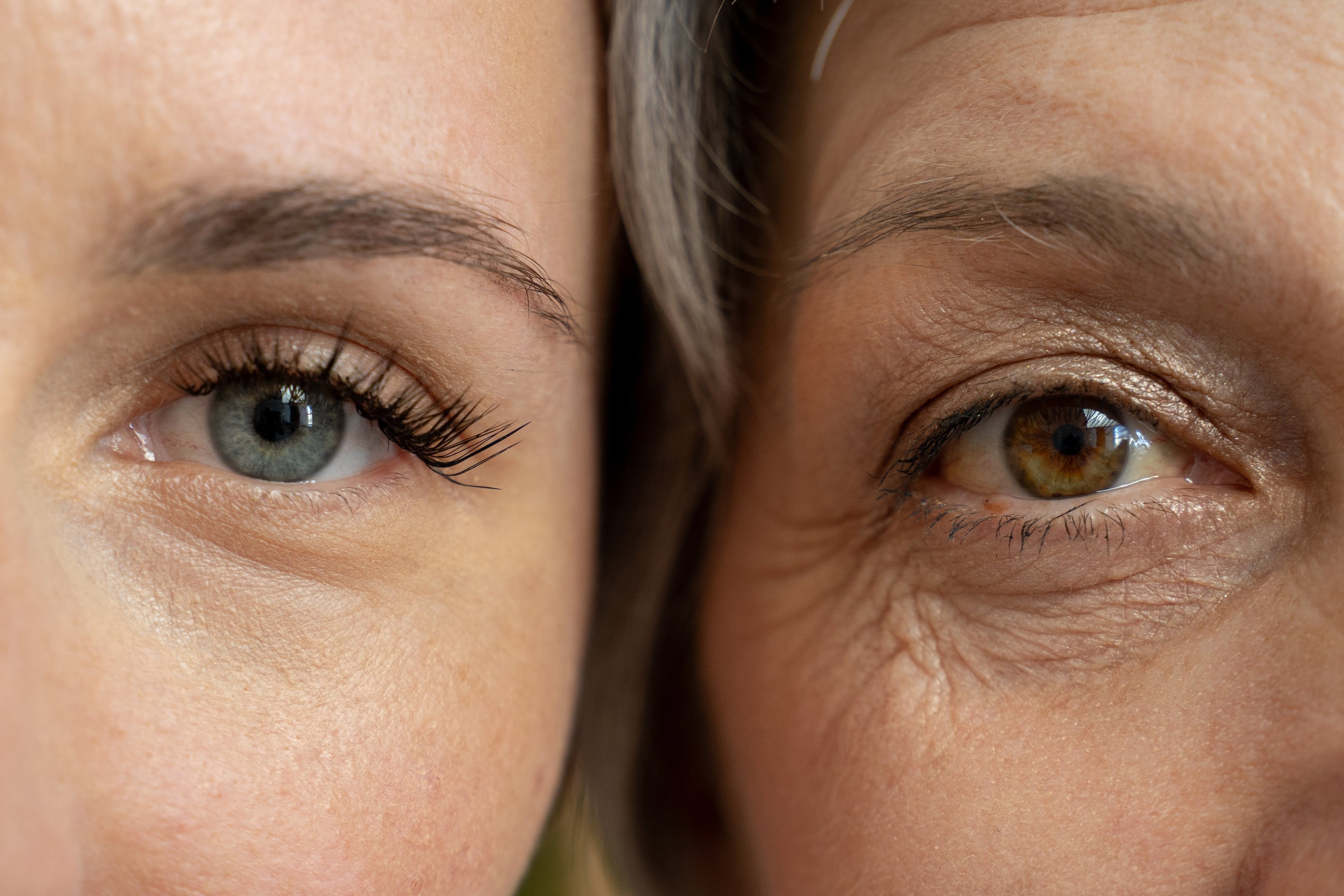 Fine Lines & Wrinkles