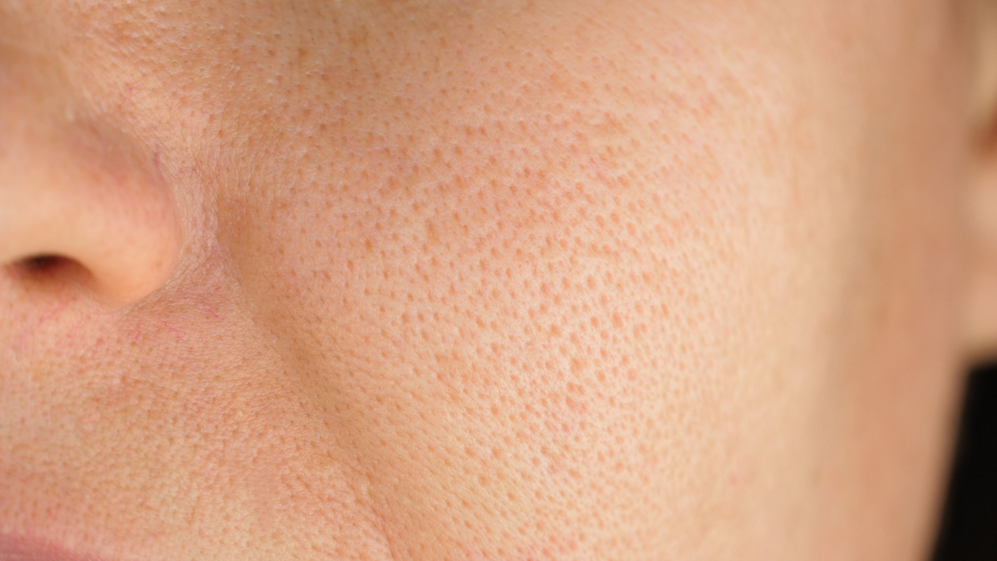 Visible Pores