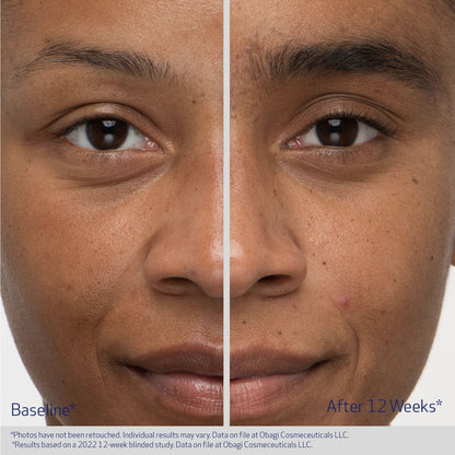 Before and after comparison of a person&