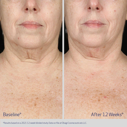Before and after comparison of a person&